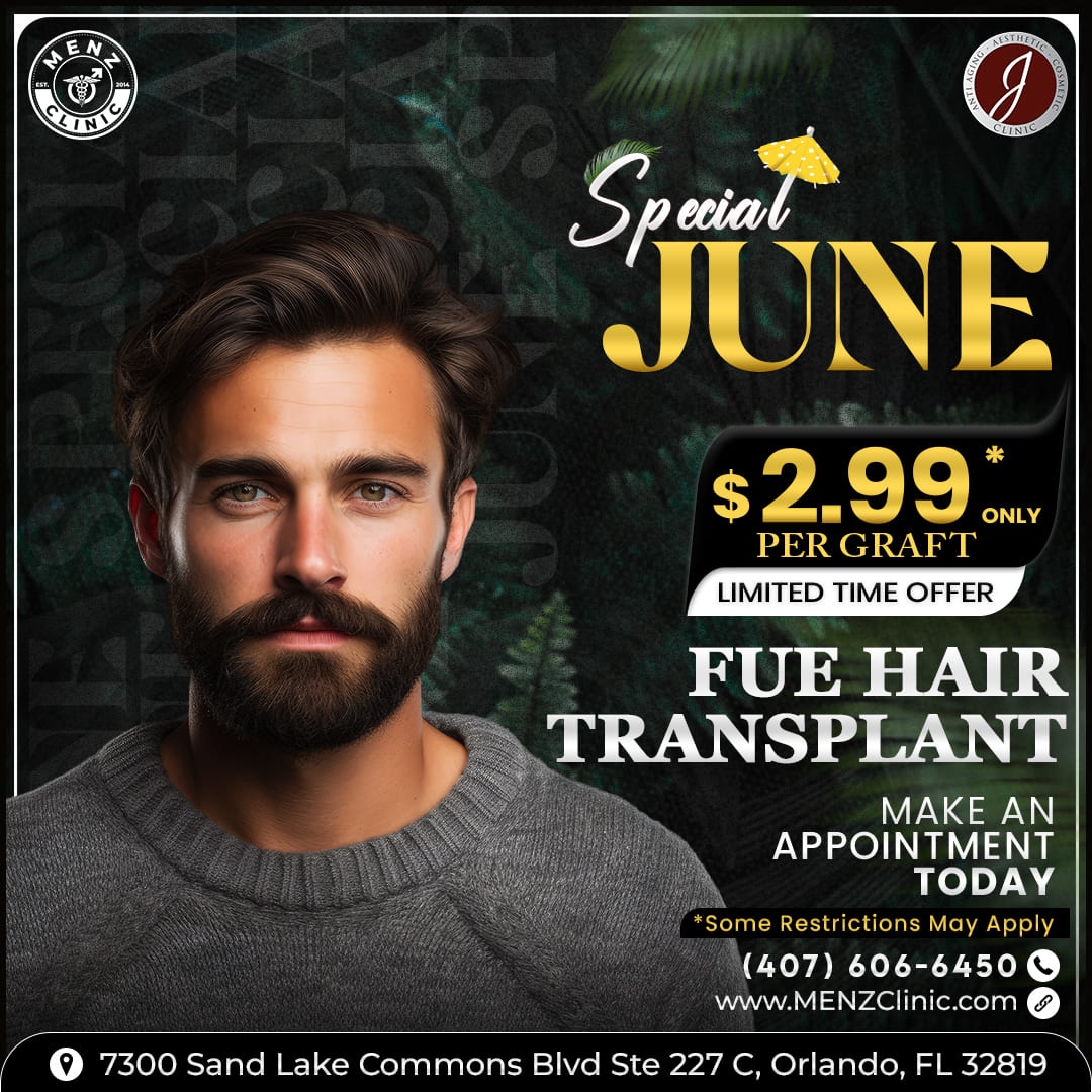 Hair-Transplant-menz