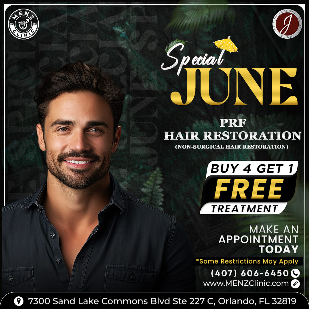 PRF-Hair-Restoration-menz